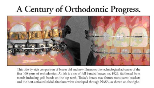 orthodontics history san antonio tx