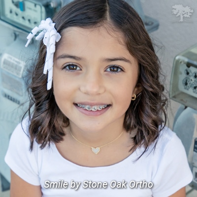 Early treatment Stone Oak Orthodontics in San Antonio, TX