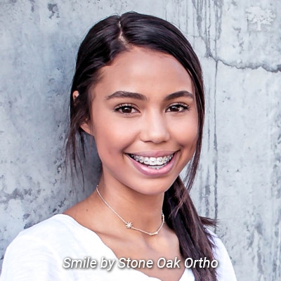 Bracket System Stone Oak Orthodontics in San Antonio, TX