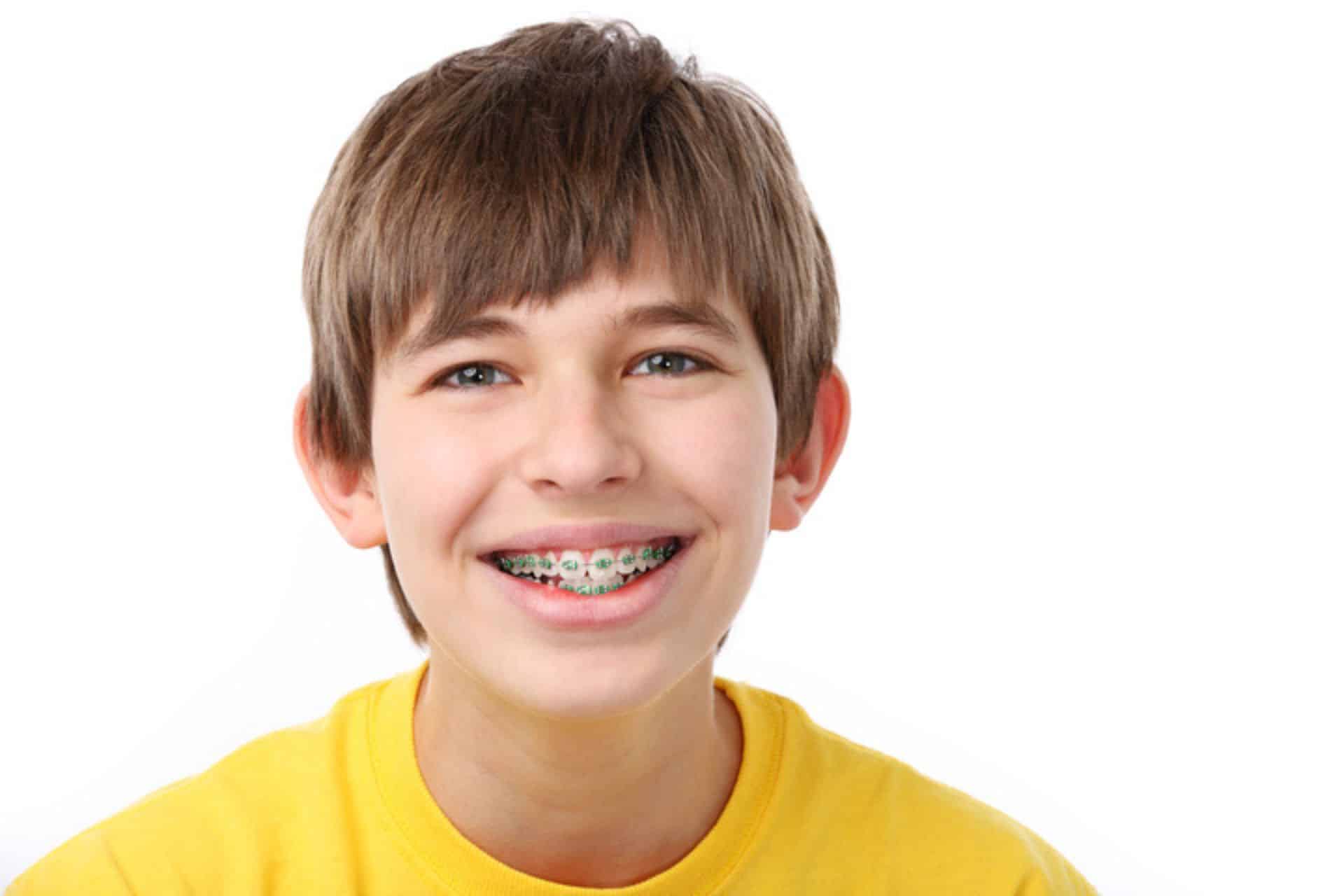 What Foods Should You Avoid With Braces? Stone Oak Orthodontics in San Antonio, TX
