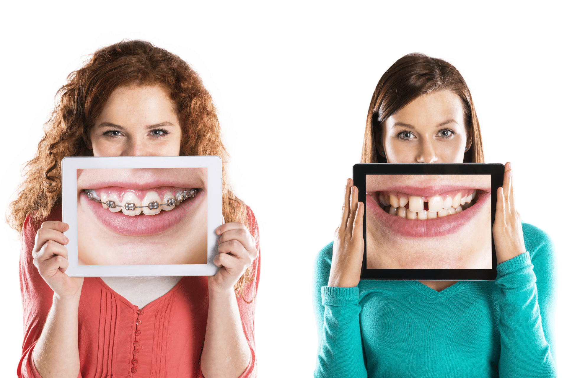 Two women holding tablets over their lower faces, showing close-up images of teeth with braces on one and a gap between teeth on the other